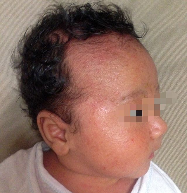 アトピー肌の赤ちゃんに効果的な保湿ケアや塗り薬はないかと検証した結果 33才から人生を変える男の物語